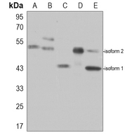 1 - Anti-MEIS1 Antibody AP60593