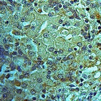 19 - Anti-MRPS25 Antibody AP60595