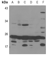 1 - Anti-MRPS25 Antibody AP60595