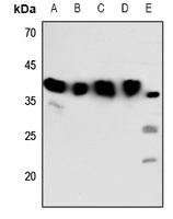 1 - Anti-Melatonin Receptor 1b Antibody AP60597