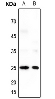 1 - Anti-Neuromedin U Antibody AP60600