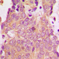 19 - Anti-NSG1 Antibody AP60601
