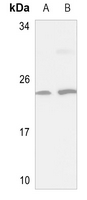 1 - Anti-NSG1 Antibody AP60601