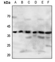 1 - Anti-P2Y4 Antibody AP60603