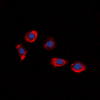 3 - Anti-P2Y8 Antibody AP60604