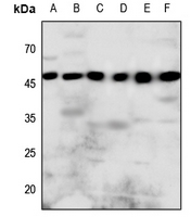 1 - Anti-P2Y8 Antibody AP60604