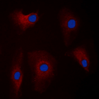 3 - Anti-Parkin Antibody AP60605