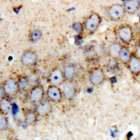 19 - Anti-Parkin Antibody AP60605