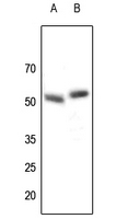 1 - Anti-Parkin Antibody AP60605
