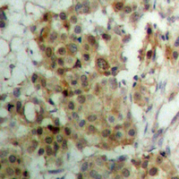 19 - Anti-Progesterone Receptor (Phospho-S190) Antibody AP60607