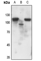 1 - Anti-Progesterone Receptor (Phospho-S190) Antibody AP60607