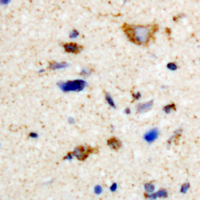 19 - Anti-MYT1 Antibody AP60608