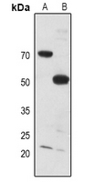 1 - Anti-MYT1 Antibody AP60608