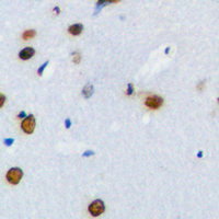 19 - Anti-PLK1 Antibody AP60609