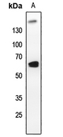 1 - Anti-PLK1 Antibody AP60609
