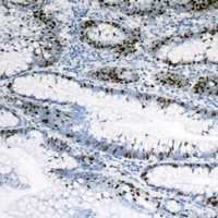 19 - Anti-PPAR gamma Antibody AP60610
