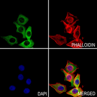 3 - Anti-MYPT1 (Phospho-T853) Antibody AP60611