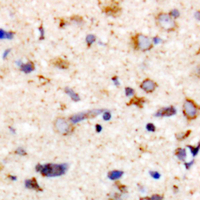 19 - Anti-MYPT1 (Phospho-T853) Antibody AP60611