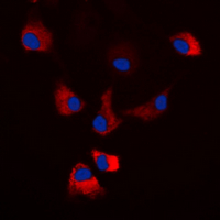 3 - Anti-PKA C alpha/beta/gamma (Phospho-T198) Antibody AP60612