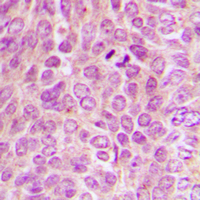 19 - Anti-PKA C alpha/beta/gamma (Phospho-T198) Antibody AP60612