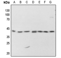 1 - Anti-PKA C alpha/beta/gamma (Phospho-T198) Antibody AP60612