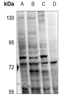 1 - Anti-PKC alpha (Phospho-T638) Antibody AP60613