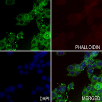 3 - Anti-PKC beta (Phospho-S661) Antibody AP60614