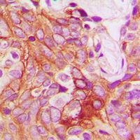 19 - Anti-PKC beta (Phospho-S661) Antibody AP60614