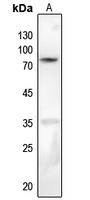 1 - Anti-PKC beta (Phospho-S661) Antibody AP60614