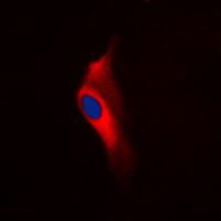 3 - Anti-PKC epsilon (Phospho-S729) Antibody AP60615
