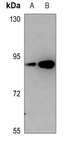 1 - Anti-PKC epsilon (Phospho-S729) Antibody AP60615