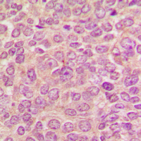 19 - Anti-PKC mu Antibody AP60616