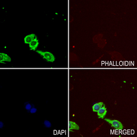 3 - Anti-PRKD2 Antibody AP60617