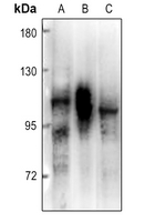 1 - Anti-PRKD2 Antibody AP60617