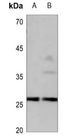 1 - Anti-CD201 Antibody AP60618