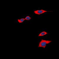 3 - Anti-PGD2 Receptor Antibody AP60620