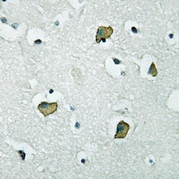 19 - Anti-PGD2 Receptor Antibody AP60620
