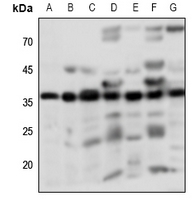 1 - Anti-PGD2 Receptor Antibody AP60620