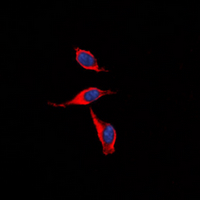 3 - Anti-IP Receptor Antibody AP60621