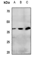 1 - Anti-IP Receptor Antibody AP60621