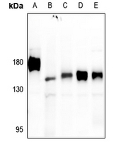 1 - Anti-PTP alpha Antibody AP60622