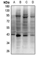1 - Anti-RAD51D Antibody AP60623