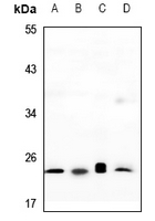 1 - Anti-RAP2C Antibody AP60624