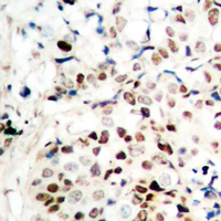 19 - Anti-CTIP Antibody AP60625