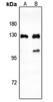 1 - Anti-CTIP Antibody AP60625