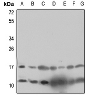 1 - Anti-RPL12 Antibody AP60626