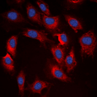 3 - Anti-S6K1 (Phospho-T412) Antibody AP60627