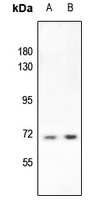 1 - Anti-S6K1 (Phospho-T412) Antibody AP60627