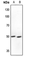 1 - Anti-S6K2 Antibody AP60628