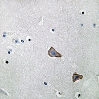19 - Anti-Secretin Receptor Antibody AP60629